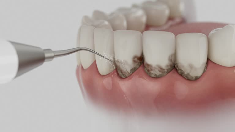Trusted Root Canal Treatment service in Haleyville, AL - Dentist Open Now
